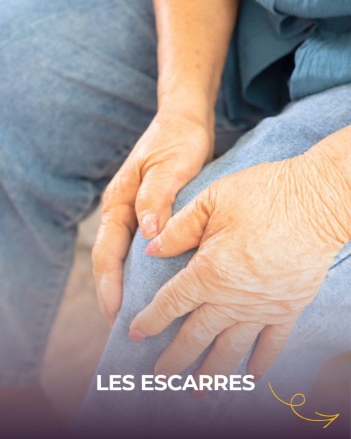 💡 Anticiper pour protéger la santé de nos aînés.

Le maintien à domicile nécessite une attention de chaque instant, notamment concernant l’intégrité de la peau. Les escarres sont des plaies cutanées qui apparaissent suite à une pression prolongée ou une mauvaise irrigation sanguine.

À l’agence, nos auxiliaires de vie sont formées pour être les premières sentinelles de cette vigilance au quotidien. 😌

Qu’elles soient liées à une pression, une friction ou même l’humidité, les escarres peuvent être évitées grâce à des gestes simples et une attention constante. Notre mission est d’assurer ce confort pour préserver la qualité de vie à domicile. 🏡

#blagnac #santé #escarres #aideadomicile #maintienadomicile